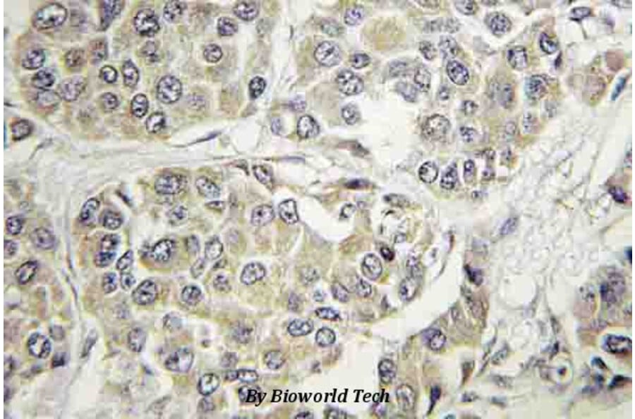 Anti-TYK2 (V1048) Antibody from Bioworld Technology (BS3713) - Antibodies.com