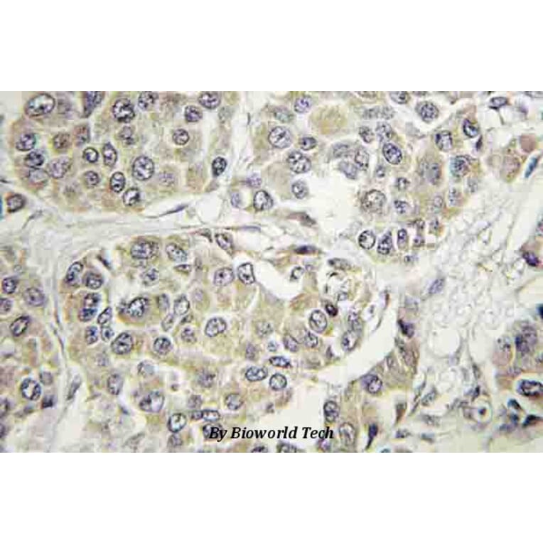 Anti-TYK2 (V1048) Antibody from Bioworld Technology (BS3713) - Antibodies.com