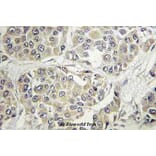 Anti-TYK2 (V1048) Antibody from Bioworld Technology (BS3713) - Antibodies.com