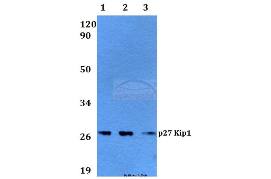 Anti-p27 Kip1 (A181) Antibody from Bioworld Technology (BS3714) - Antibodies.com
