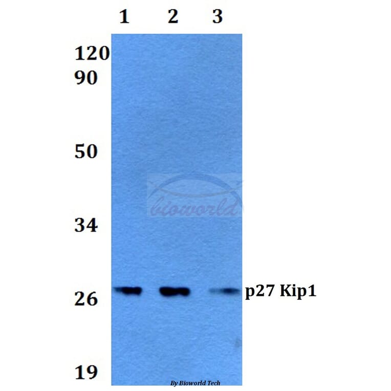 Anti-p27 Kip1 (A181) Antibody from Bioworld Technology (BS3714) - Antibodies.com