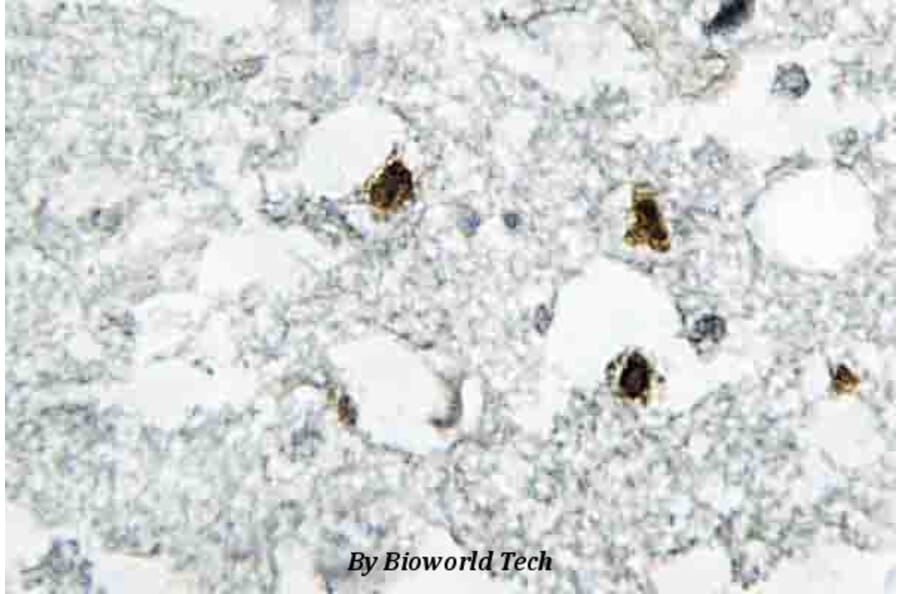 Anti-p27 Kip1 (A181) Antibody from Bioworld Technology (BS3714) - Antibodies.com