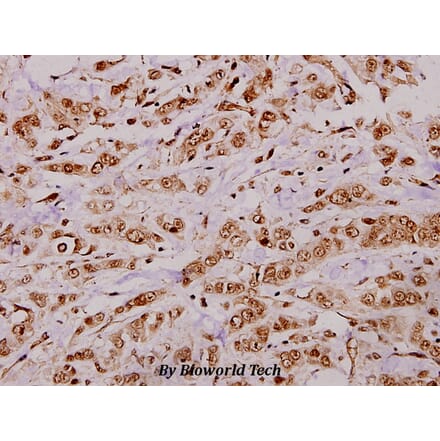 Anti-CREB (K236) Antibody from Bioworld Technology (BS3715) - Antibodies.com