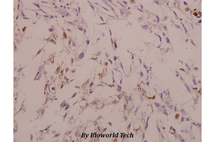 Anti-MAPKAPK-2 (N218) Antibody from Bioworld Technology (BS3720) - Antibodies.com