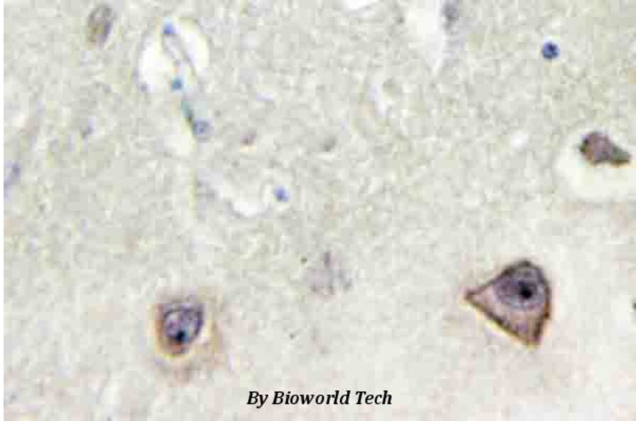 Anti-NMDAζ1 (F891) Antibody from Bioworld Technology (BS3721) - Antibodies.com