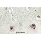 Anti-NMDAζ1 (F891) Antibody from Bioworld Technology (BS3721) - Antibodies.com