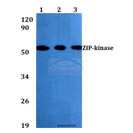 Anti-ZIP-kinase (K261) Antibody from Bioworld Technology (BS3724) - Antibodies.com
