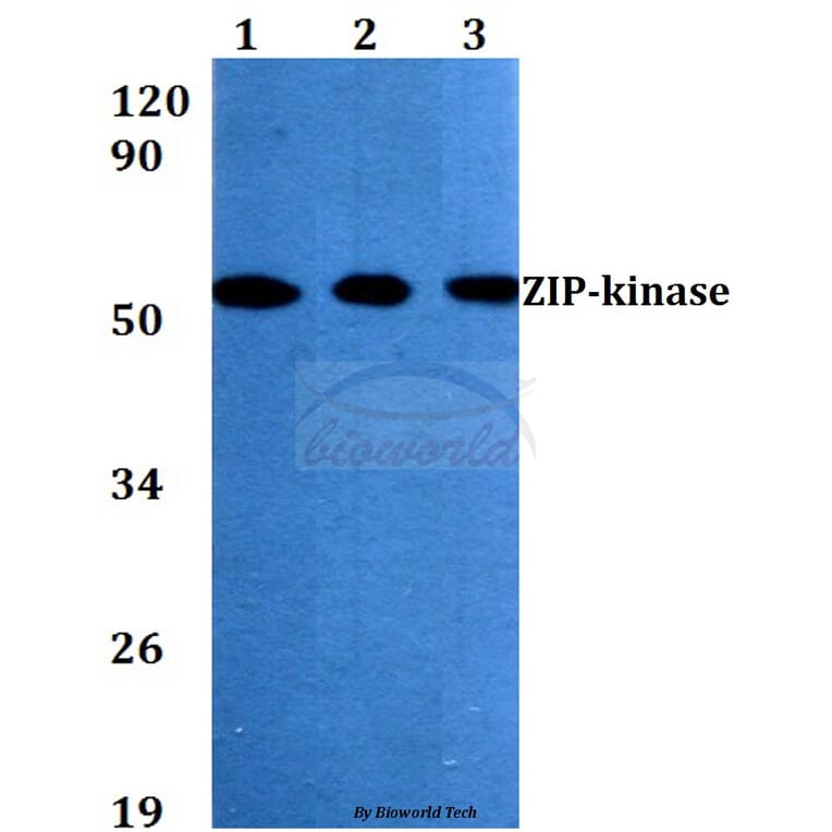 Anti-ZIP-kinase (K261) Antibody from Bioworld Technology (BS3724) - Antibodies.com