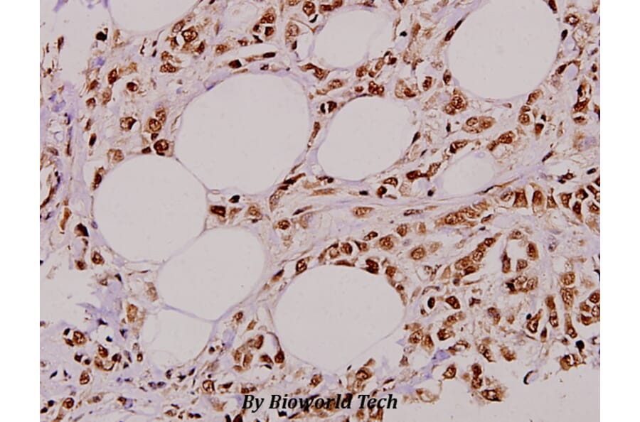 Anti-ZIP-kinase (K261) Antibody from Bioworld Technology (BS3724) - Antibodies.com