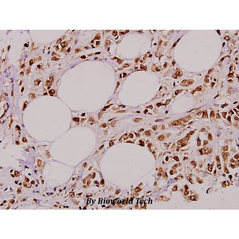 Anti-ZIP-kinase (K261) Antibody from Bioworld Technology (BS3724) - Antibodies.com