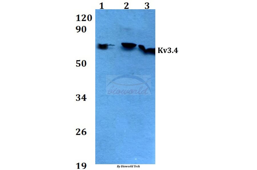 Anti-Kv3.4 (R11) Antibody from Bioworld Technology (BS3728) - Antibodies.com