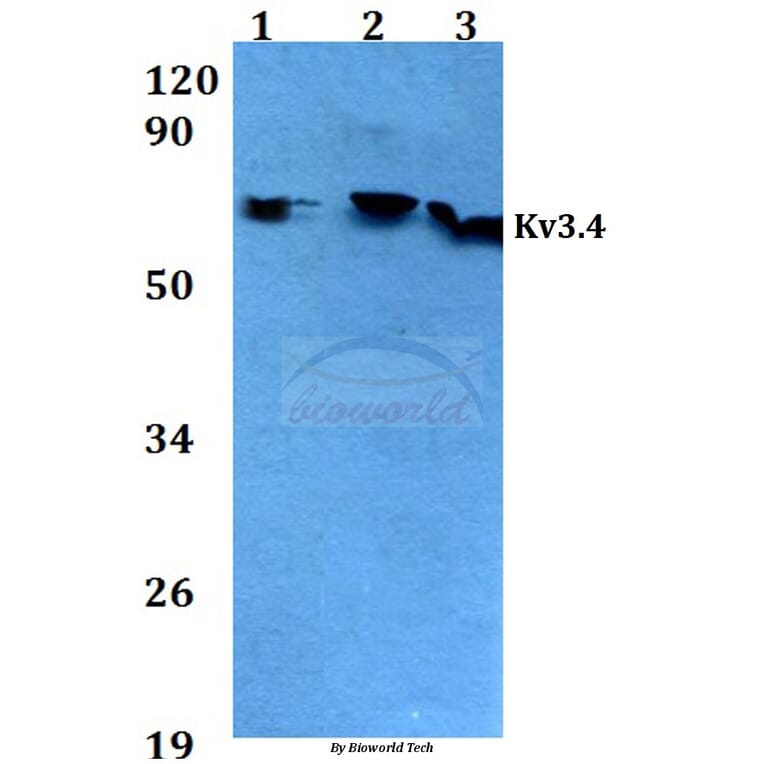 Anti-Kv3.4 (R11) Antibody from Bioworld Technology (BS3728) - Antibodies.com