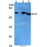 Anti-Kv3.4 (R11) Antibody from Bioworld Technology (BS3728) - Antibodies.com