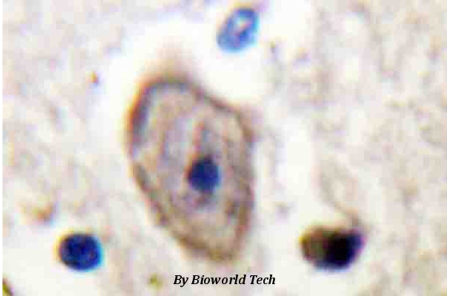 Anti-Kv3.4 (R11) Antibody from Bioworld Technology (BS3728) - Antibodies.com