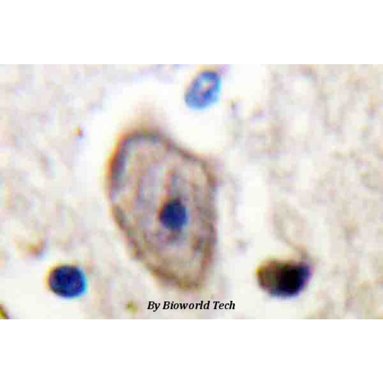 Anti-Kv3.4 (R11) Antibody from Bioworld Technology (BS3728) - Antibodies.com