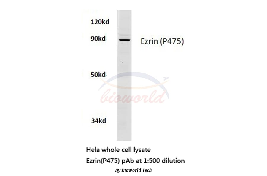 Anti-Ezrin (P475) Antibody from Bioworld Technology (BS3733) - Antibodies.com