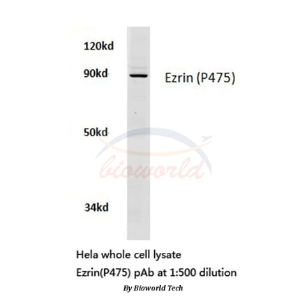 Anti-Ezrin (P475) Antibody from Bioworld Technology (BS3733) - Antibodies.com