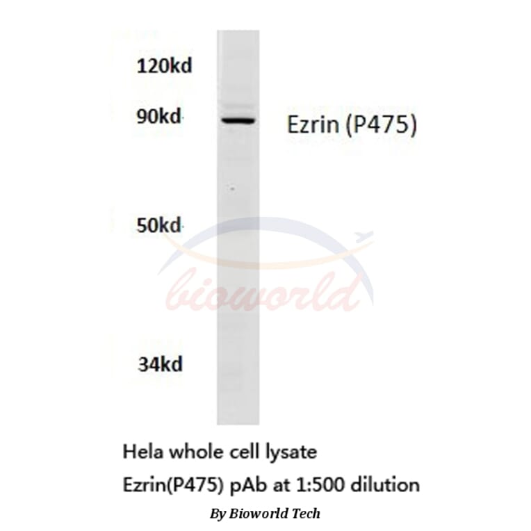 Anti-Ezrin (P475) Antibody from Bioworld Technology (BS3733) - Antibodies.com