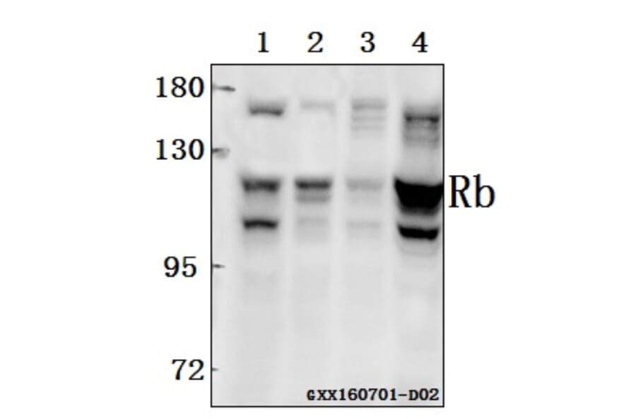 Anti-Rb (T601) Antibody from Bioworld Technology (BS3737) - Antibodies.com