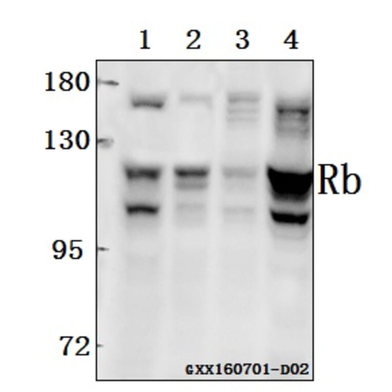 Anti-Rb (T601) Antibody from Bioworld Technology (BS3737) - Antibodies.com