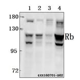 Anti-Rb (T601) Antibody from Bioworld Technology (BS3737) - Antibodies.com
