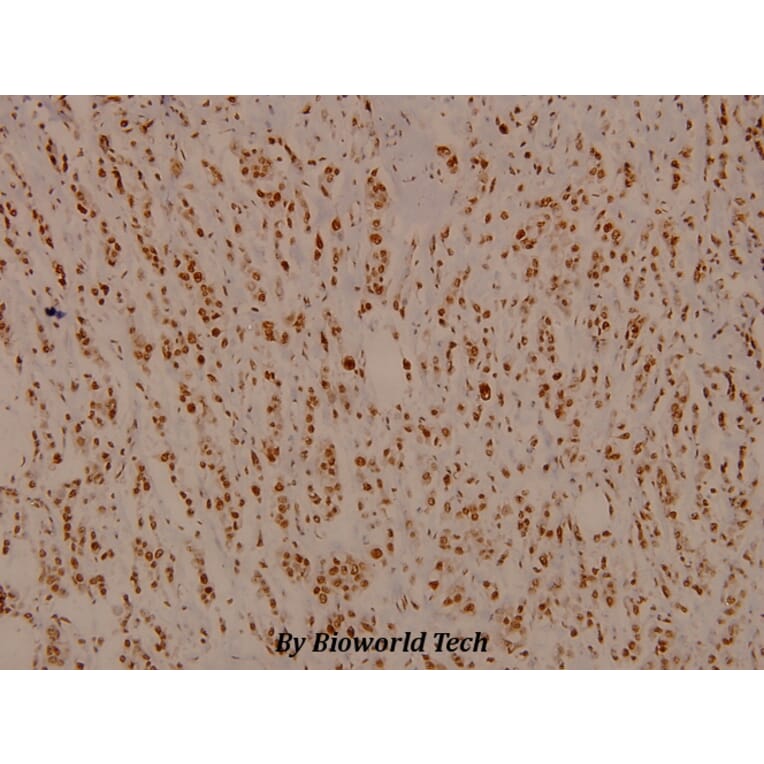 Anti-Rb (T601) Antibody from Bioworld Technology (BS3737) - Antibodies.com