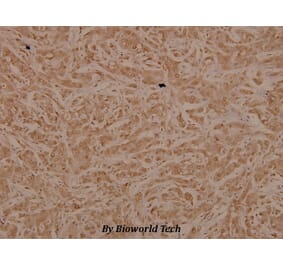 Anti-Tak1 (D181) Antibody from Bioworld Technology (BS3745) - Antibodies.com