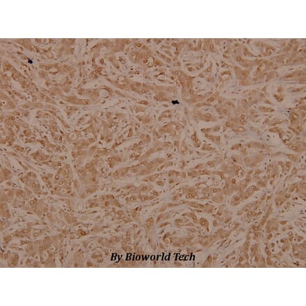 Anti-Tak1 (D181) Antibody from Bioworld Technology (BS3745) - Antibodies.com