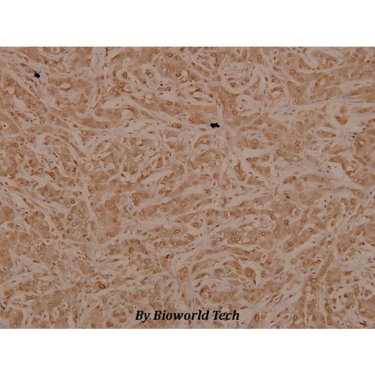 Anti-Tak1 (D181) Antibody from Bioworld Technology (BS3745) - Antibodies.com