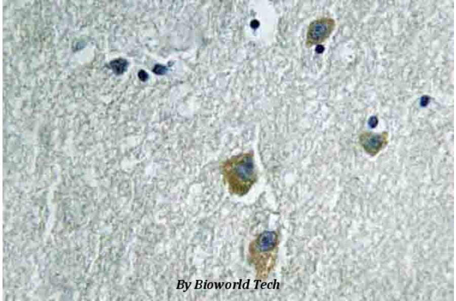Anti-PAK1 (K198) Antibody from Bioworld Technology (BS3750) - Antibodies.com
