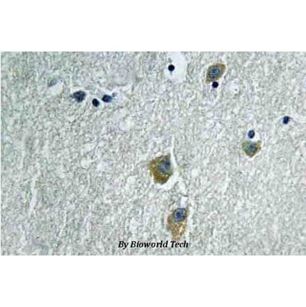 Anti-PAK1 (K198) Antibody from Bioworld Technology (BS3750) - Antibodies.com