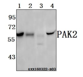 Anti-PAK2 (R186) Antibody from Bioworld Technology (BS3751) - Antibodies.com