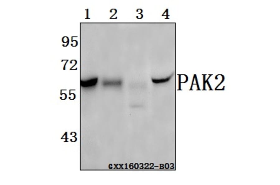 Anti-PAK2 (R186) Antibody from Bioworld Technology (BS3751) - Antibodies.com