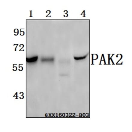 Anti-PAK2 (R186) Antibody from Bioworld Technology (BS3751) - Antibodies.com