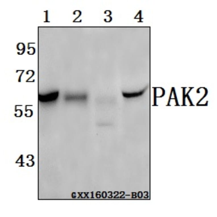 Anti-PAK2 (R186) Antibody from Bioworld Technology (BS3751) - Antibodies.com