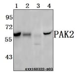 Anti-PAK2 (R186) Antibody from Bioworld Technology (BS3751) - Antibodies.com