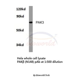 Anti-PAK3 (N148) Antibody from Bioworld Technology (BS3752) - Antibodies.com