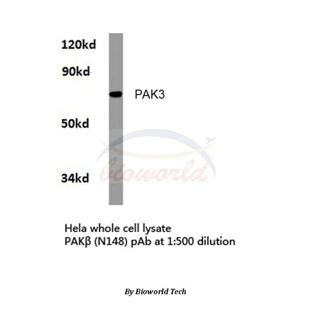 Anti-PAK3 (N148) Antibody from Bioworld Technology (BS3752) - Antibodies.com