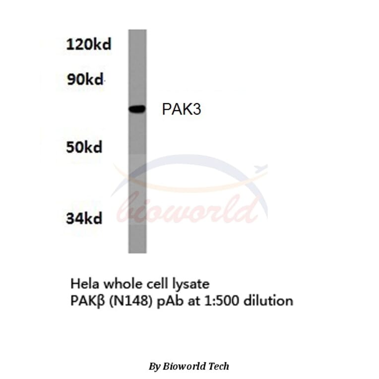 Anti-PAK3 (N148) Antibody from Bioworld Technology (BS3752) - Antibodies.com