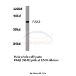 Anti-PAK3 (N148) Antibody from Bioworld Technology (BS3752) - Antibodies.com