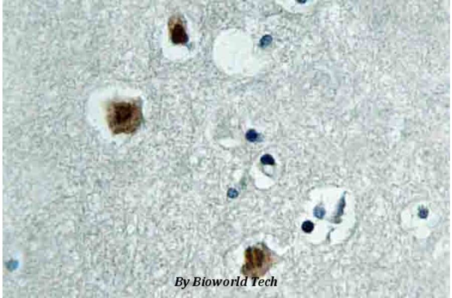 Anti-PAK3 (N148) Antibody from Bioworld Technology (BS3752) - Antibodies.com
