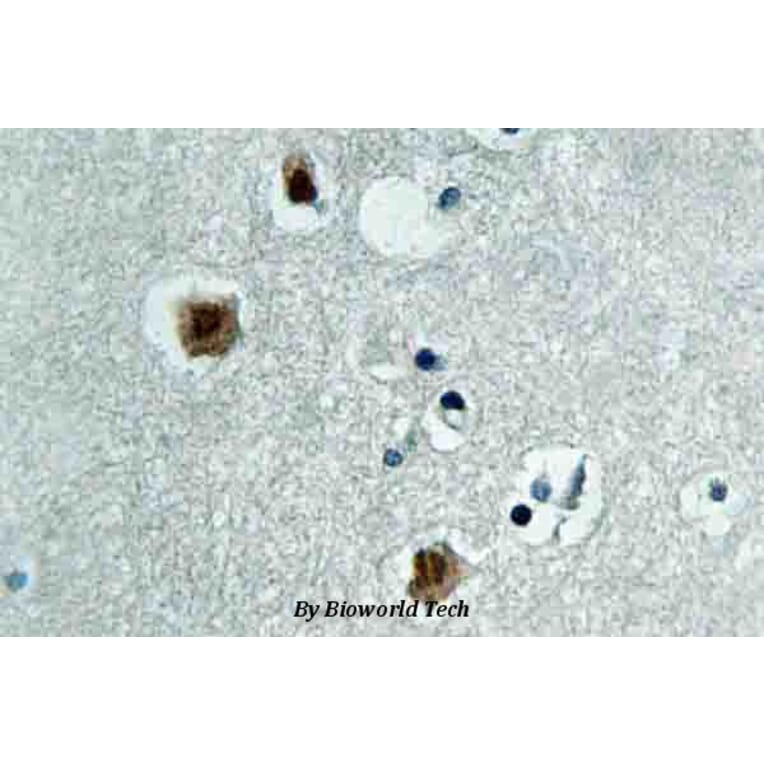 Anti-PAK3 (N148) Antibody from Bioworld Technology (BS3752) - Antibodies.com