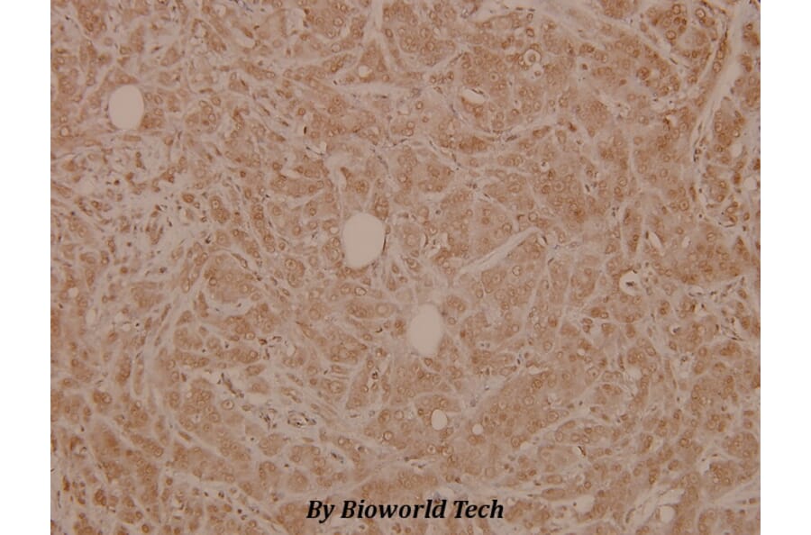 Anti-SLP-76 (G122) Antibody from Bioworld Technology (BS3758) - Antibodies.com