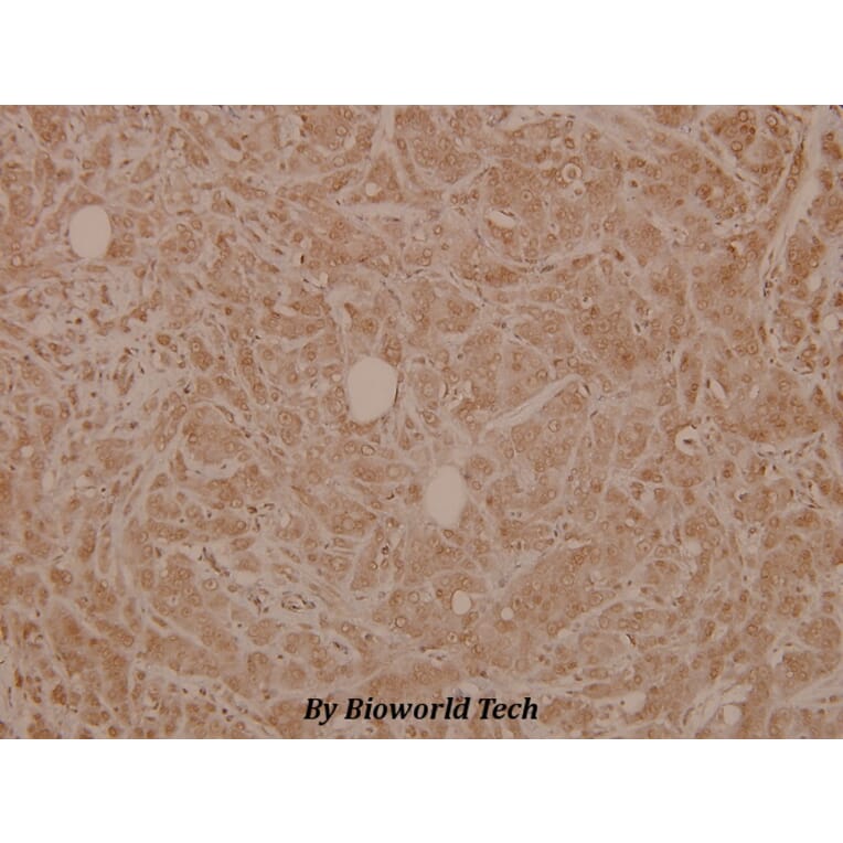 Anti-SLP-76 (G122) Antibody from Bioworld Technology (BS3758) - Antibodies.com