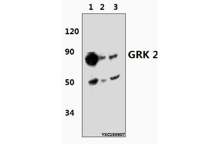 Anti-GRK 2 (V678) Antibody from Bioworld Technology (BS3762) - Antibodies.com