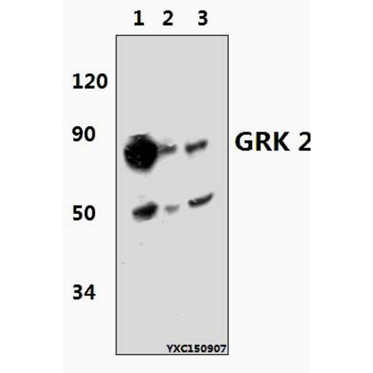 Anti-GRK 2 (V678) Antibody from Bioworld Technology (BS3762) - Antibodies.com
