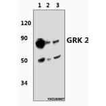 Anti-GRK 2 (V678) Antibody from Bioworld Technology (BS3762) - Antibodies.com