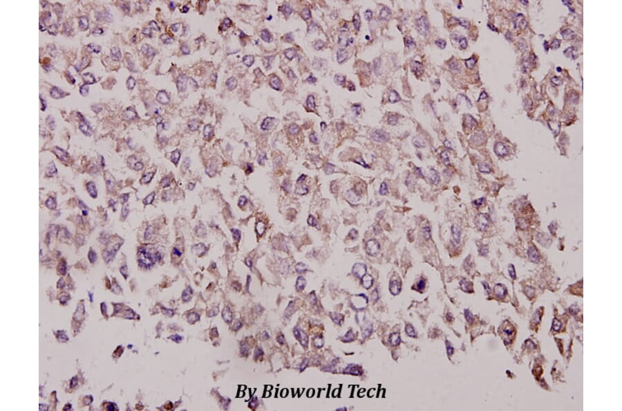 Anti-GRK 2 (V678) Antibody from Bioworld Technology (BS3762) - Antibodies.com