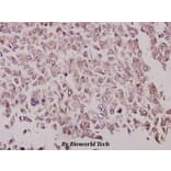 Anti-GRK 2 (V678) Antibody from Bioworld Technology (BS3762) - Antibodies.com