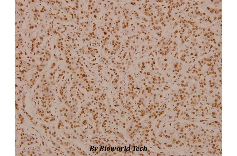 Anti-MAPKAPK-2 (N266) Antibody from Bioworld Technology (BS3766) - Antibodies.com